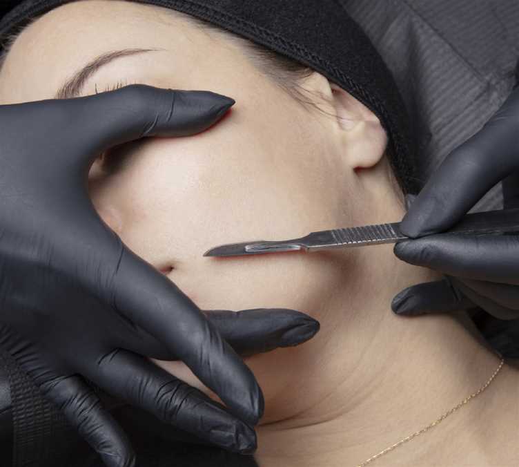 Aesthetic services - Dermaplaning