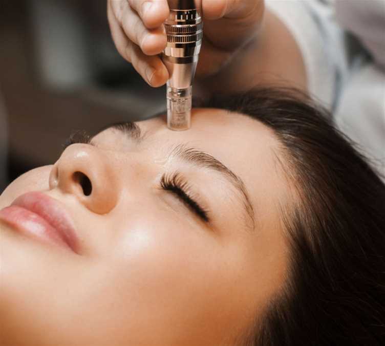 Aesthetic services - Microneedling