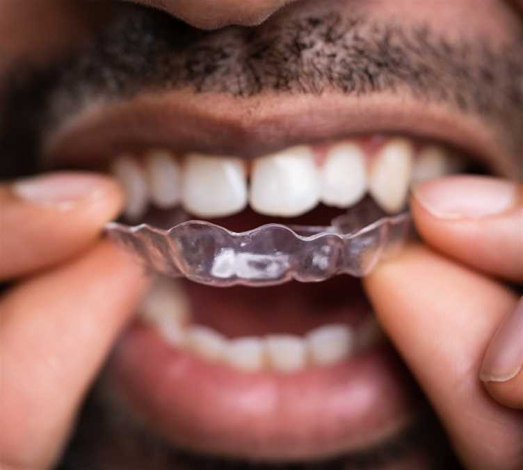 Aesthetic services - Preventative